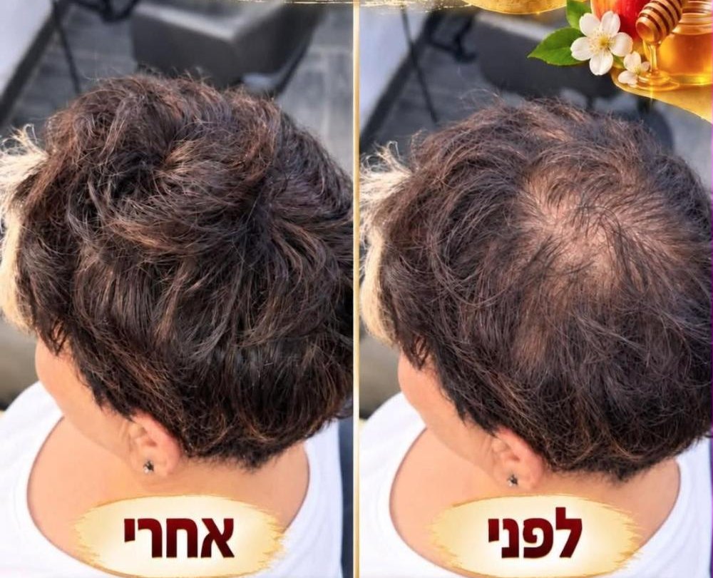 לפני ואחרי: מילוי דלילות בקודקוד